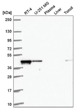 RMND5A Antibody, Novus Biologicals:Antibodies:Primary Antibodies