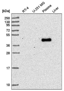 RNF135 Antibody, Novus Biologicals 100&mu;L; Unlabeled:Antibodies, Polyclonal