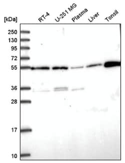 RNF168 Antibody, Novus Biologicals 25 &mu;L:Antibodies, Polyclonal