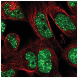 RNF169 Antibody, Novus Biologicals 100&mu;L; Unlabeled:Antibodies, Polyclonal