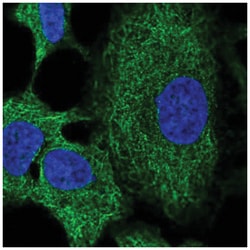 RNF215 Antibody, Novus Biologicals:Antibodies:Primary Antibodies