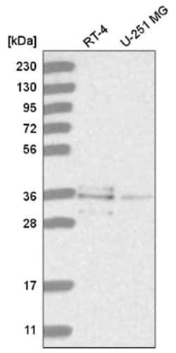 RNF220 Antibody, Novus Biologicals 100&mu;L; Unlabeled:Antibodies, Polyclonal