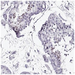 RNF32 Antibody, Novus Biologicals:Antibodies:Primary Antibodies