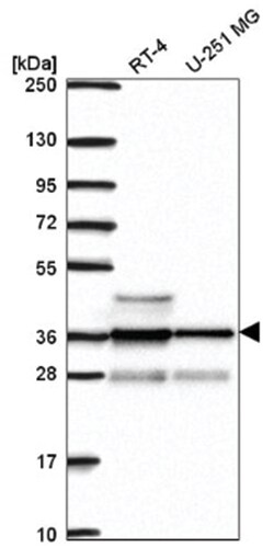 RNF34 Antibody, Novus Biologicals 100&mu;L; Unlabeled:Antibodies, Polyclonal