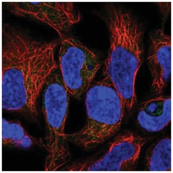 RNF5 Antibody, Novus Biologicals 100&mu;L; Unlabeled:Antibodies, Polyclonal