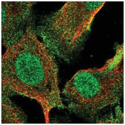 RNF8 Antibody, Novus Biologicals 100&mu;L; Unlabeled:Antibodies, Polyclonal