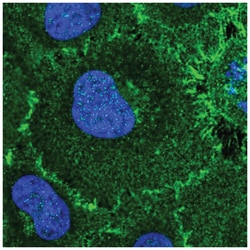 ROBO1 Antibody, Novus Biologicals 25 &mu;L:Antibodies, Polyclonal