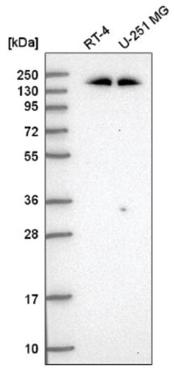 ROCK2 Antibody, Novus Biologicals 25 &mu;L, Unlabeled:Antibodies, Polyclonal