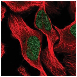 ROD1 Antibody, Novus Biologicals 25 &mu;L, Unlabeled:Antikörper