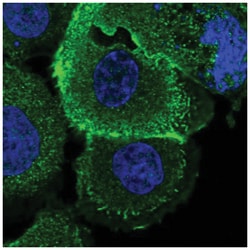 ROM1 Antibody, Novus Biologicals:Antibodies:Primary Antibodies