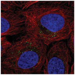 ROS Antibody, Novus Biologicals 25 &mu;L:Antibodies, Polyclonal
