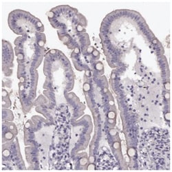 RP1L1 Antibody, Novus Biologicals:Antibodies:Primary Antibodies