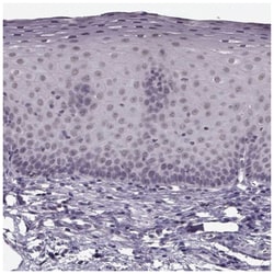 RP1L1 Antibody, Novus Biologicals:Antibodies:Primary Antibodies