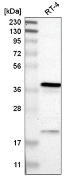 RP2 Antibody, Novus Biologicals:Antibodies:Primary Antibodies
