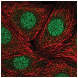 RP9 Antibody, Novus Biologicals 100&mu;L; Unlabeled:Antibodies, Polyclonal