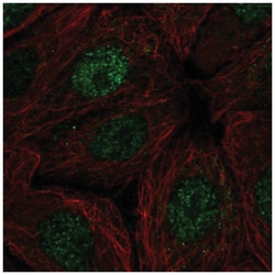 RPB9 Antibody, Novus Biologicals 100&mu;L; Unlabeled:Antibodies, Polyclonal