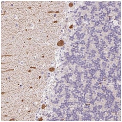 RPGRIP1 Antibody, Novus Biologicals 25 &mu;L:Antibodies, Polyclonal