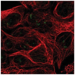 RPL7L1 Antibody, Novus Biologicals 25 &mu;L:Antibodies, Polyclonal