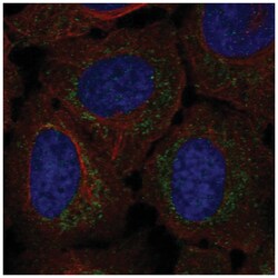RPP14 Antibody, Novus Biologicals 100&mu;L; Unlabeled:Antibodies, Polyclonal