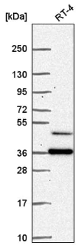 RPRD1B Antibody, Novus Biologicals 100&mu;L; Unlabeled:Antibodies, Polyclonal