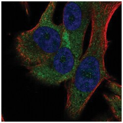 RPS18 Antibody, Novus Biologicals 25 &mu;L:Antibodies, Polyclonal
