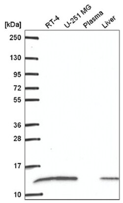RPS27L Antibody, Novus Biologicals 100 &mu;L | Buy Online | Novus Biologicals | Fisher Scientific