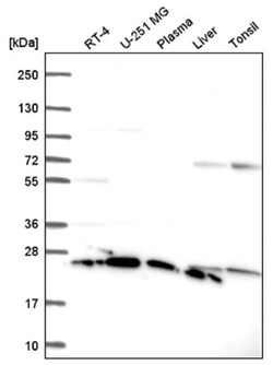 RPS5 Antibody, Novus Biologicals 100 &mu;L | Buy Online | Novus Biologicals | Fisher Scientific