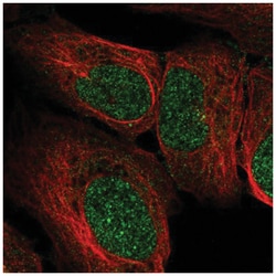 RRP4 Antibody, Novus Biologicals:Antibodies:Primary Antibodies