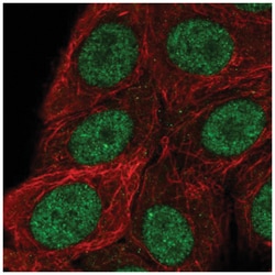 RSF1 Antibody, Novus Biologicals 100&mu;L; Unlabeled:Antibodies, Polyclonal
