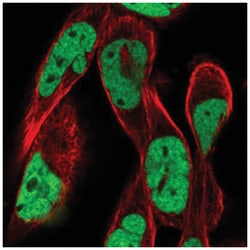 RSF1 Antibody, Novus Biologicals 100&mu;L; Unlabeled:Antibodies, Polyclonal