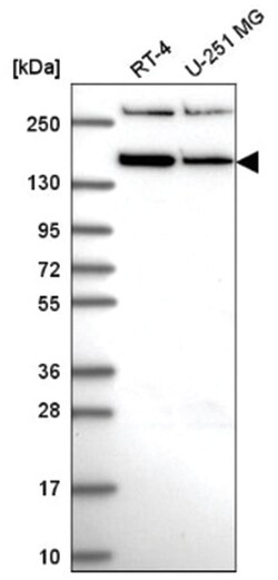 RSF1 Antibody, Novus Biologicals 100&mu;L; Unlabeled:Antibodies, Polyclonal