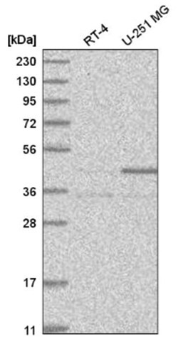 RTCD1 Antibody, Novus Biologicals 100&mu;L; Unlabeled:Antibodies, Polyclonal