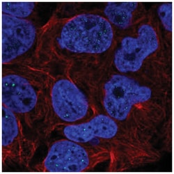 RTEL1 Antibody, Novus Biologicals 25 &mu;L, Unlabeled:Antibodies, Polyclonal