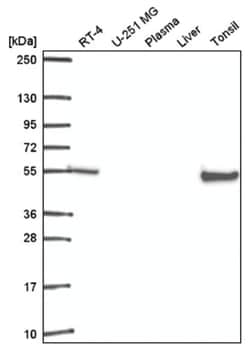 RXR beta/NR2B2 Antibody, Novus Biologicals 25 &mu;L, Unlabeled:Antibodies,