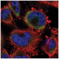 S100A3 Antibody, Novus Biologicals 100 &mu;L | Buy Online | Novus Biologicals | Fisher Scientific