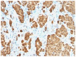 S100B Rabbit anti-Bovine, Human, Mouse, Rat, Clone-S100B/1706R, Novus Biologicals™