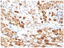 S100B Mouse anti-Bovine, Human, Mouse, Rat, Clone-SPM354, Novus Biologicals