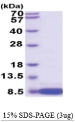 Novus Biologicals Recombinant Mouse S100B Protein 100 &mu;g | Buy Online | Novus Biologicals&trade; | Fisher Scientific