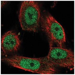 SA1 Antibody, Novus Biologicals 25 &mu;L:Antibodies, Polyclonal