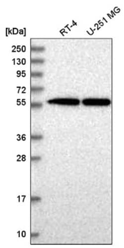 SAAL1 Antibody, Novus Biologicals 100&mu;L; Unlabeled:Antibodies, Polyclonal
