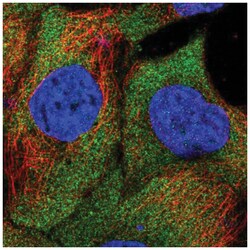 SAMD4B Antibody, Novus Biologicals 25 &mu;L:Antibodies, Polyclonal
