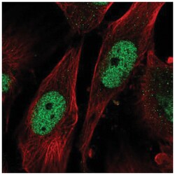 SAP30 Antibody, Novus Biologicals 100&mu;L; Unlabeled:Antibodies, Polyclonal