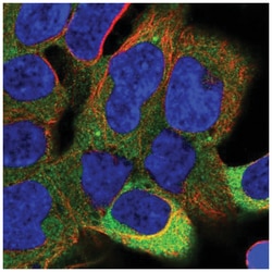 SAPS1 Antibody, Novus Biologicals 25 &mu;L | Buy Online | Novus Biologicals | Fisher Scientific