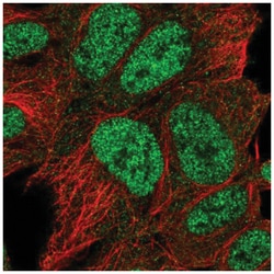 SATB1 Antibody, Novus Biologicals 25 &mu;L:Antibodies, Polyclonal