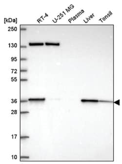 SC5DL Antibody, Novus Biologicals 100&mu;L; Unlabeled:Antibodies, Polyclonal