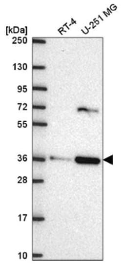 SCAMP3 Antibody, Novus Biologicals 100&mu;L; Unlabeled:Antibodies, Polyclonal