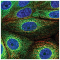 SCD-1 Antibody, Novus Biologicals 100&mu;L; Unlabeled:Antibodies, Polyclonal