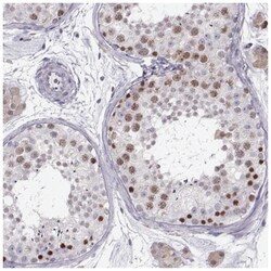 SCML2 Antibody, Novus Biologicals 100&mu;L; Unlabeled:Antibodies, Polyclonal