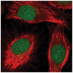 SCNM1 Antibody, Novus Biologicals 100&mu;L; Unlabeled:Antibodies, Polyclonal
