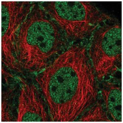SCP2/SYCP2 Antibody, Novus Biologicals 100&mu;L; Unlabeled:Antibodies,